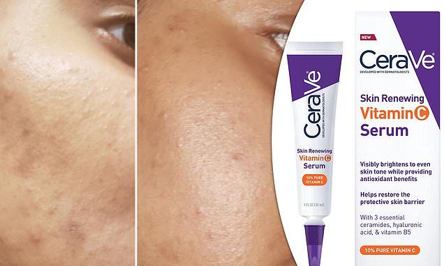 Skin Renewing Vitamin C Serum