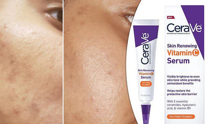 Skin Renewing Vitamin C Serum